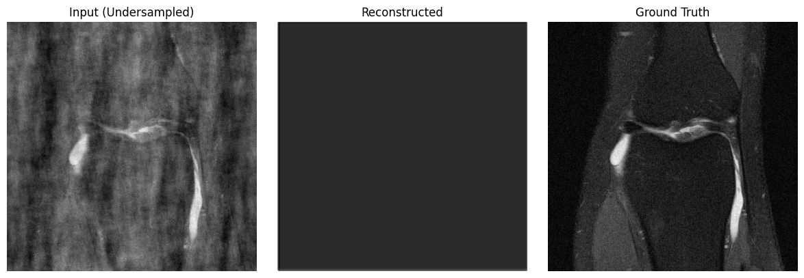 Experimental MRI output: undersampled input, early reconstruction, and ground truth